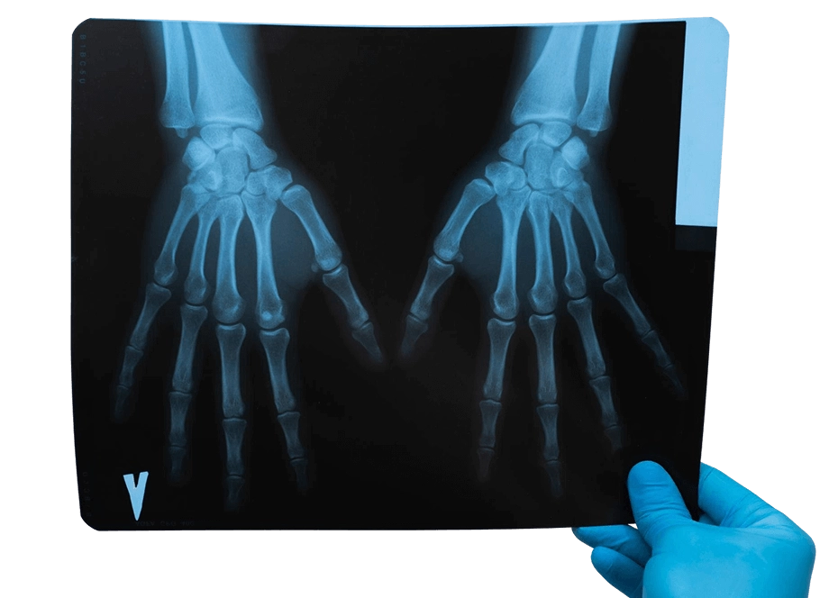 врач держит в руке рентгеновский снимок